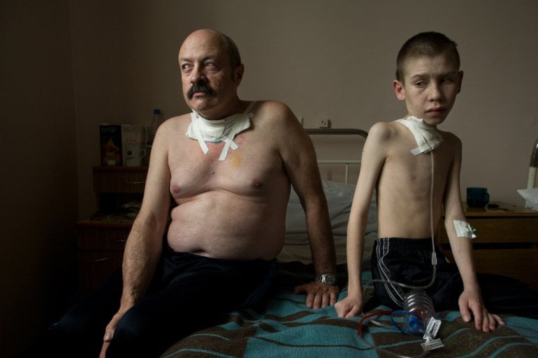 Suffering from thyroid cancer, Oleg Shairo, 54, and Dima Bogdanovich, 13, receive